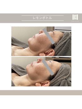 カリスボーテ 関本店/レモンボトル