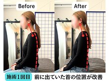 整体院 爽良/【札幌/大通り】姿勢改善