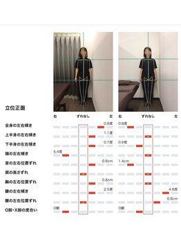 女性専用整体サロン　ベル 岩国店/ 【50代】姿勢Before After