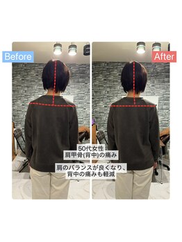 整体サロン　アンティオール　大森本店【頭痛/不眠/耳鳴り/腰痛/肩こり/骨盤矯正】/Before→After【背中の痛み】