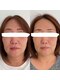 星月夜の写真/【 宜野湾で美容鍼灸が受けられる 】国家資格が必要な施術だからエステ・マッサージと一味違う効果を実感！
