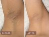 【まずはワキから♪】脱毛★ツルスベ肌♪気になる自己処理が◎￥3,000