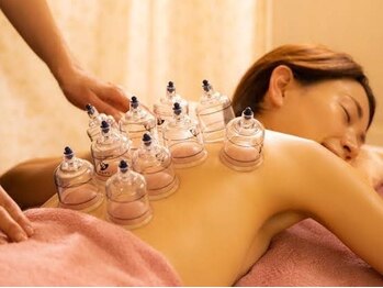 ツリービューティー(Tree Beauty)の写真/【カッピング×オイルマッサージ】免疫力を高め身体の不調改善!血流,リンパの流れを促進!不眠や自律神経に