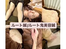 サス(SASU)の雰囲気（どんな悩みからでも《卒業》《終わりのある鍼》希望のルート鍼）