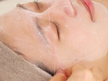 アップル マリー 江別/■糸脱毛