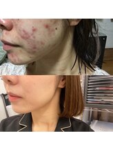 サロン ド ルル(salon de Lulu)/人気No. 1★セルキュア