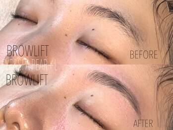 パール(PEAR+L)/ハリウッドブロウリフト