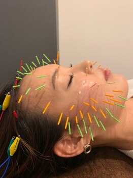 ジェイペック鍼灸整骨院の写真/【鍼灸師にお任せ】お顔の悩みを、解剖学で整える！1人1人に合わせた丁寧な手技で自分史上最高の小顔へ