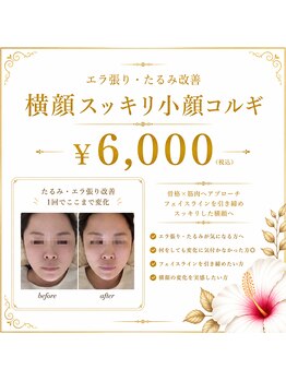ピーエム(P.M)/エラ張りたるみ改善小顔ケア