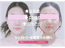 トゥインクル 麻布(twinkle)