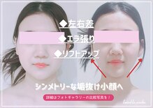 トゥインクル 麻布(twinkle)