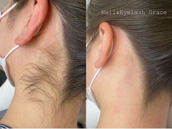 ネイル アンド アイラッシュ グレイス(Grace)/うなじのWAX脱毛