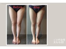 ビューティーサロン アール(R)/痩身マシーン足