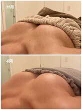 美人バスト 旭川店/バストアップ◇症例◇