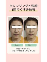 マインドール/洗顔変えただけでくすみ変化！