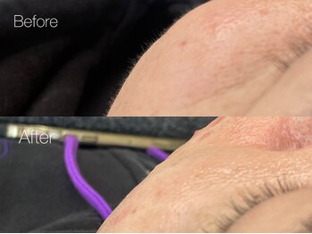 シス(sis)/フェイシャルwax