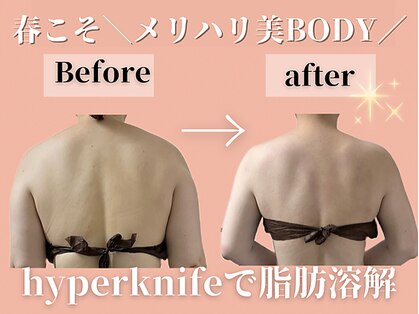 エステサロン ヴリエ 立川店の写真