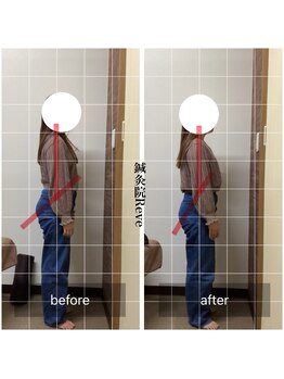 わきさか鍼灸整骨院・鍼灸院 レーヴ(Reve)/優しい矯正だけど見た目も変化♪