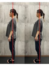 エミット(emit)/１回のセッションで姿勢改善