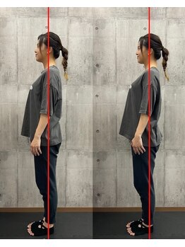 エミット(emit)/1回のセッションで姿勢改善