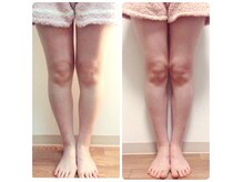 コース終了すっきり美脚♪足裏からのゆがみ解消で足長効果も