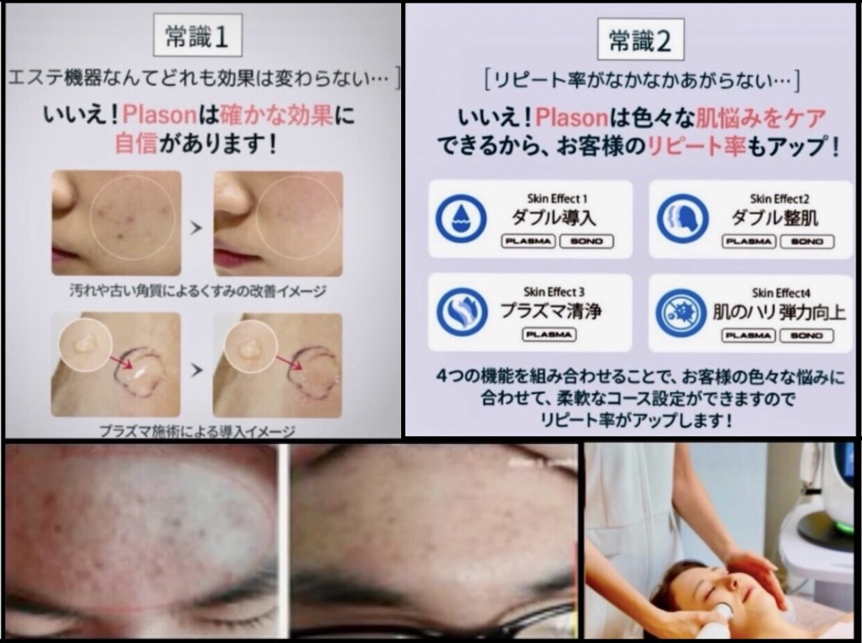 エステサロンでも使用！リンパインピーダンスII　新品未使用 お客様からの口コミのご紹介です♪ こちらでインディバを施術し