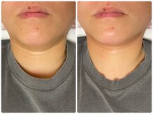 シュガー(Sugar...iyr)/レッドショット