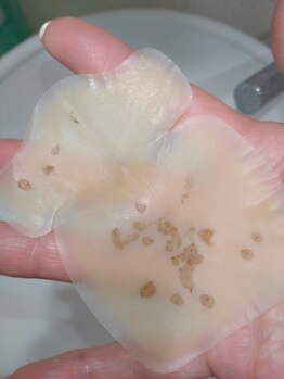 アイラッシュ ラボ ヒトミ(Eyelash Lab Hitomi)/1週間でシミがペロン♪