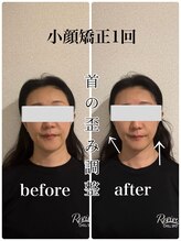 リバイブ 自由が丘店(REVIVE)/小顔矯正+ドライヘッドスパ1回