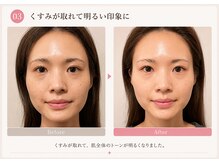 モアフェイス 池袋店(More Face)/　小顔矯正・左右差矯正・リンパ