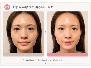 モアフェイス 池袋店(More Face)/　小顔矯正・左右差矯正・リンパ
