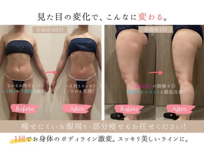 サンオーラ(SUN AURA)の写真