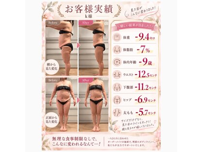 ユノン(yunon)の写真