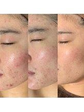 サロン バイオビオ(SALON BioBio)/