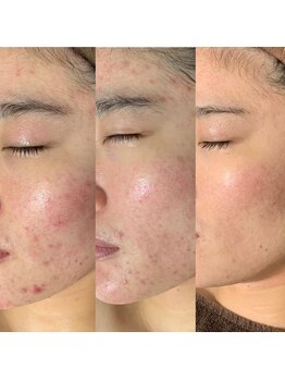 サロン バイオビオ(SALON BioBio)/