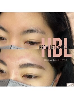 エリス(ELISSE)/ハリウッドブロウリフト