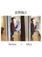 心斎橋長堀フェムテック整骨院/31姿勢矯正　骨格矯正と骨盤矯正