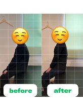 ナオル整体 長崎大村院(NAORU整体)/70代女性施術事例【猫背矯正】