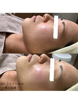 フォーユー マシバメディカル(For You Mashiba Medical)/エンビロン