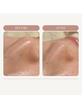 エミナル バイ ニコドット(Eminal by nico.)/触った時のざらつきがお悩み