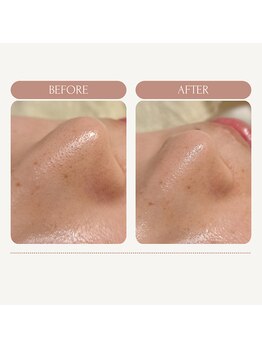 エミナル バイ ニコドット(Eminal by nico.)/触った時のざらつきがお悩み