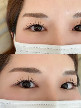 ワンルーム(01 ROOM)/&healthy140本