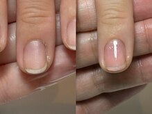 ネイルズ バイ ユイ 外苑前(Nails by Yui)/自爪育成ネイルケア