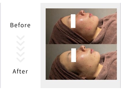 レガリア(LEGAREA)の写真