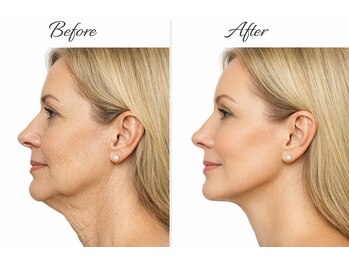 エステティック ライム(Esthetic Lime)/何度も見たくなる!!イケてる小顔