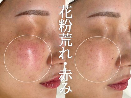 ジェム(gemme)の写真