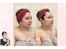 えすてさろん ケイアンドエフ(k&f)の雰囲気（肌質とフェイスラインを整え印象まで変えるケア）