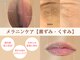 フェミニン(Feminine)の写真/フェムケアサロンで安心の短期集中ケア！メラニンケアで黒ずみケアを目指す★