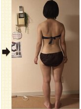ノットノット 自由が丘(Not Knot)/２.ボディ スペシャル施術１回後
