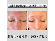 ソレイユ(Soleil)の雰囲気（お悩みに合わせ完全オーダーメイド施術で肌質改善☆韓国艶肌♪）